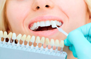 Estética dental Estoclinic Terrassa