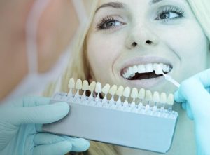 Blanqueamiento dental Estoclinic Terrassa