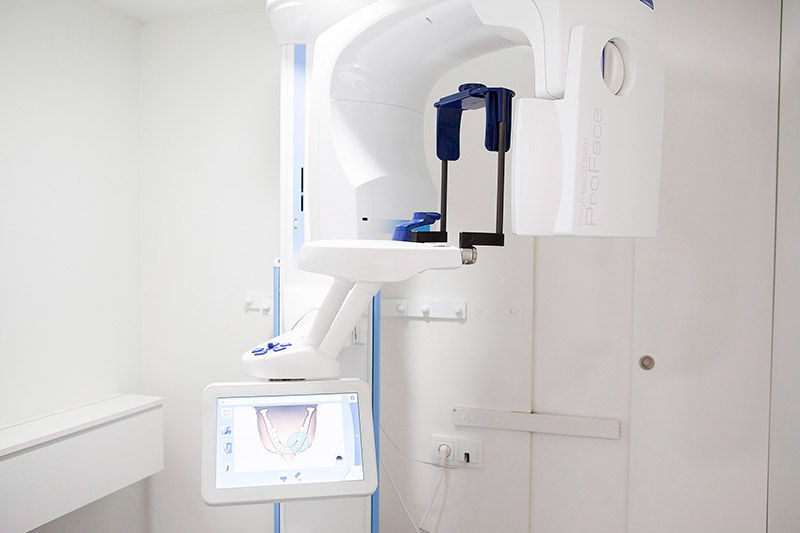 Escáner CBCT