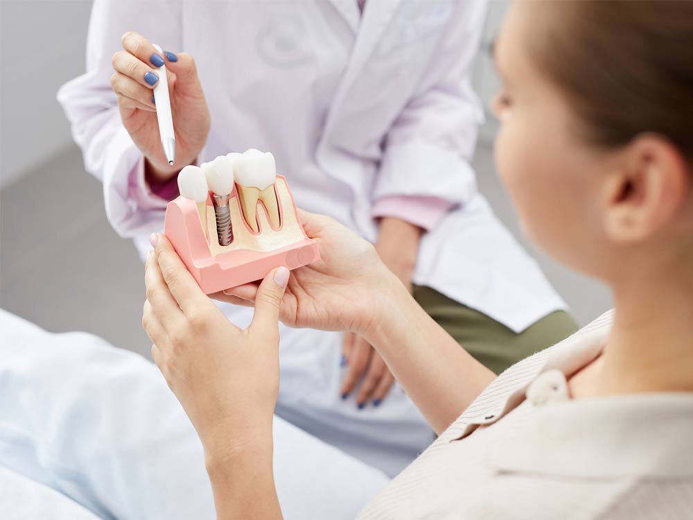 Implantes dentales ESTOCLINIC Clínica dental Terrassa