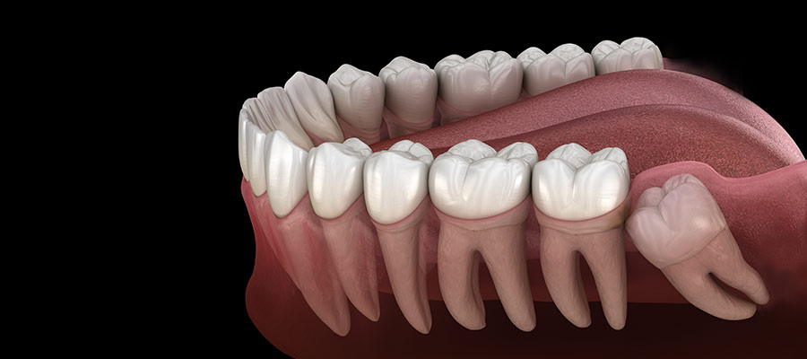 Cirugía oral ESTOCLINIC Clínica dental Terrassa