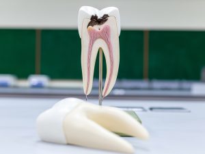 Odontología conservadora Estoclinic Terrassa