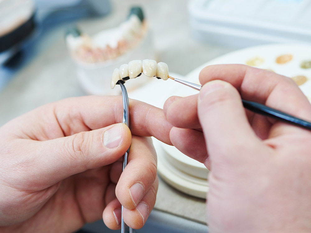 Tratamientos prótesis dentales. ESTOCLINIC Clínica Dental Terrassa